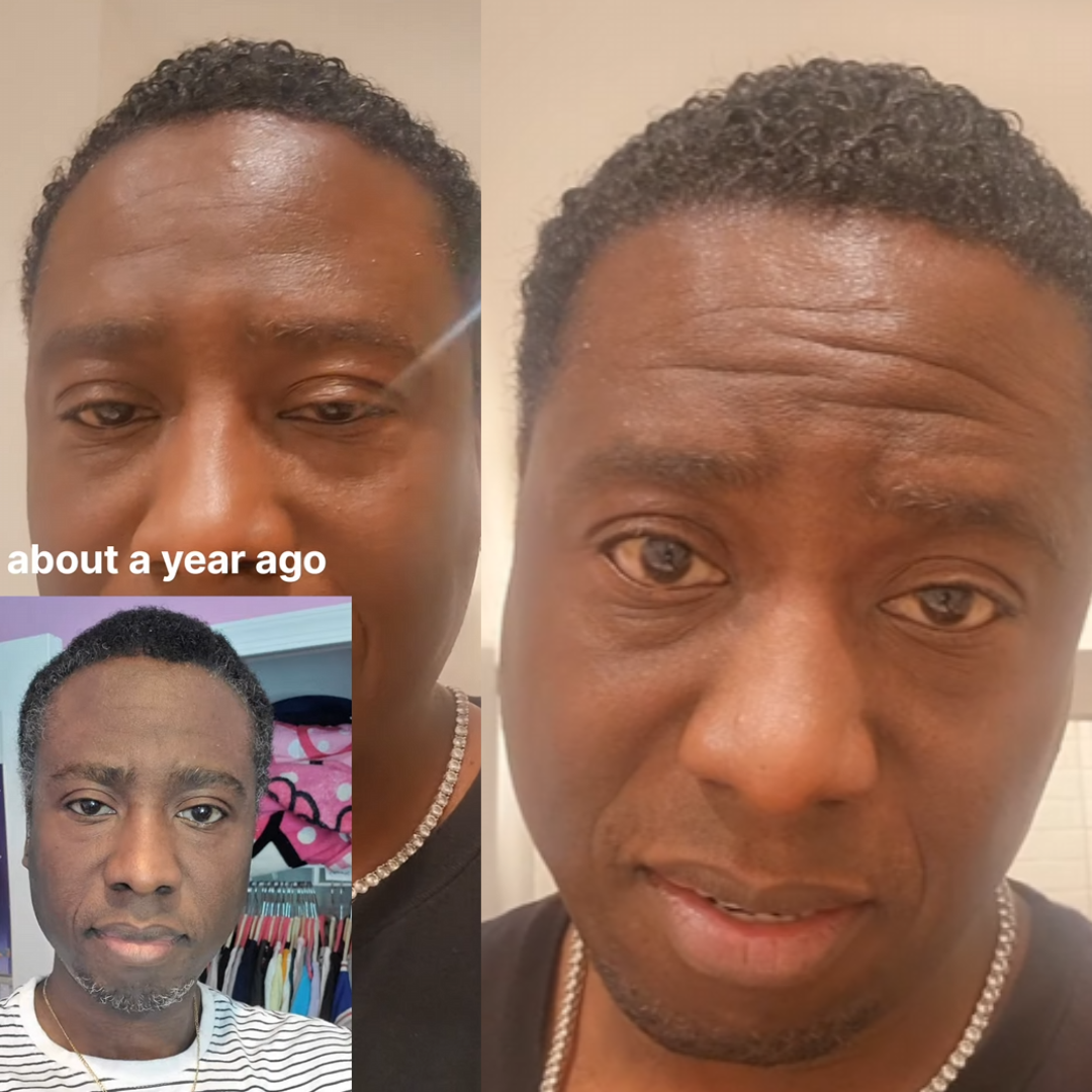 Melanin® Instant Dye Shampoo for 4C Hair